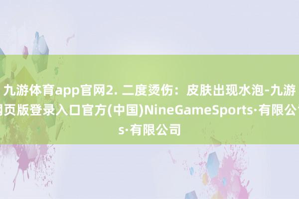 九游体育app官网2. 二度烫伤：皮肤出现水泡-九游网页版登录入口官方(中国)NineGameSpo